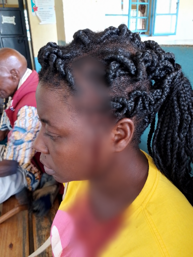 I need protection: Siaya woman appeals for help after alleged machete attack by husband